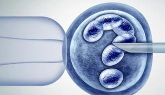 试管婴儿的技术及详细步骤，需要做试管婴儿的情况分析