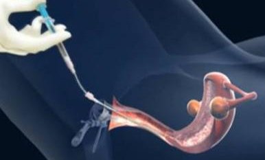 上海集爱医院试管怎么样？可以做怀孕吗？