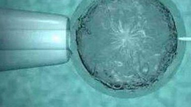 高胆固醇血症可以去厦门做试管吗？大概需要花费多少钱？